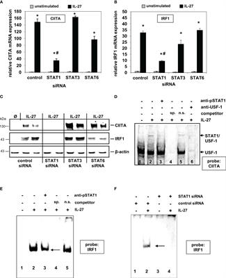 Identification of IL-27 as a novel regulator of major histocompatibility complex class I and class II expression, antigen presentation, and processing in intestinal epithelial cells